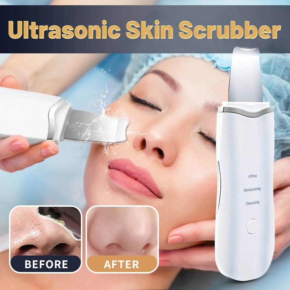 Ultrasonic Skin Scrubber | Deep Pore Cleaner & Blackhead Remover – At - Home Spa Exfoliation