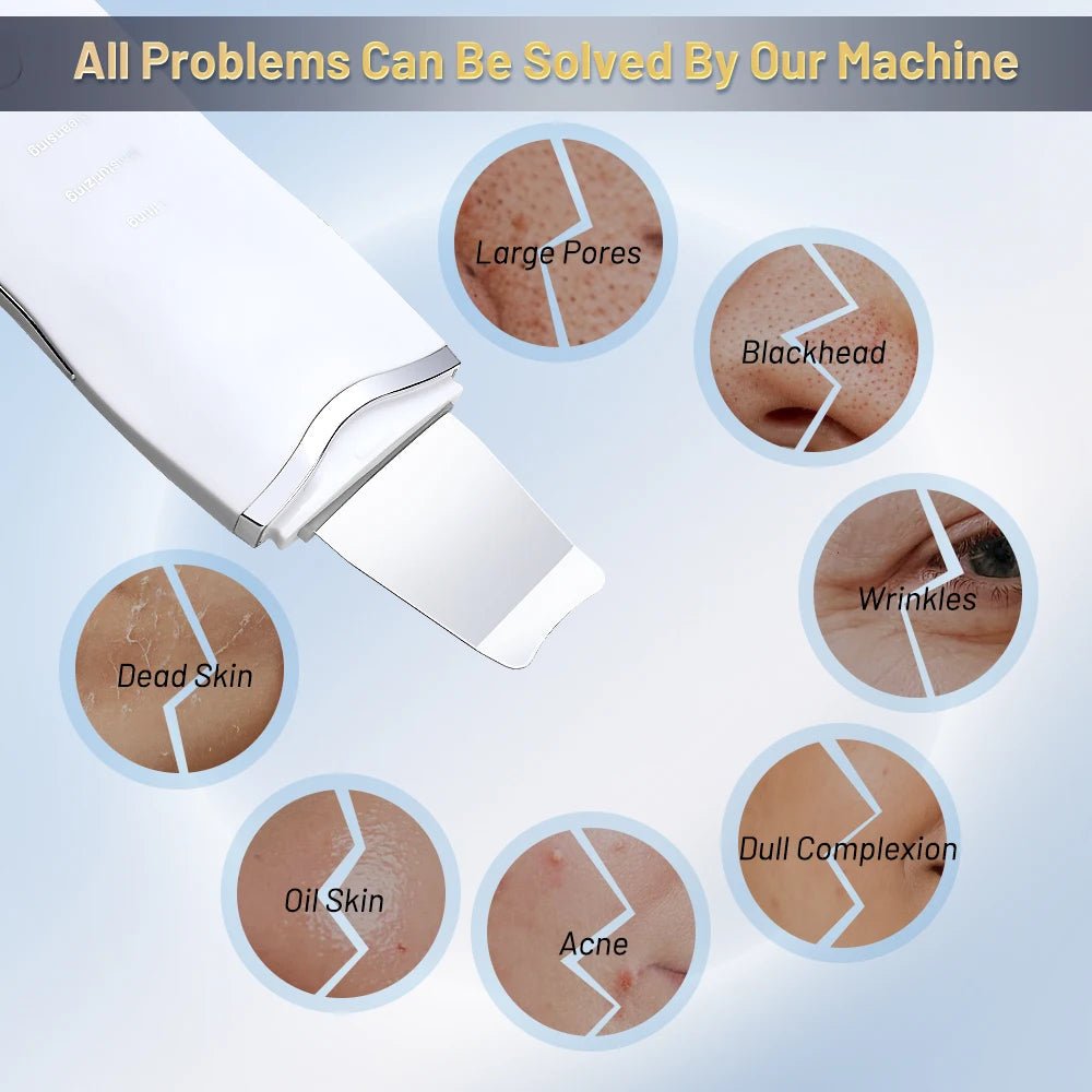 Ultrasonic Skin Scrubber | Deep Pore Cleaner & Blackhead Remover – At - Home Spa Exfoliation
